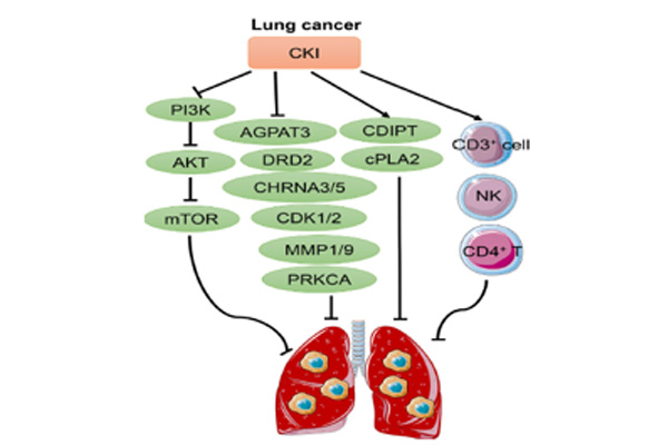 复方苦参注射液医治肺癌