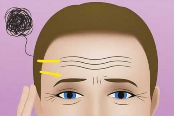 仰面纹,出现仰面纹的原因,若何淡化仰面纹